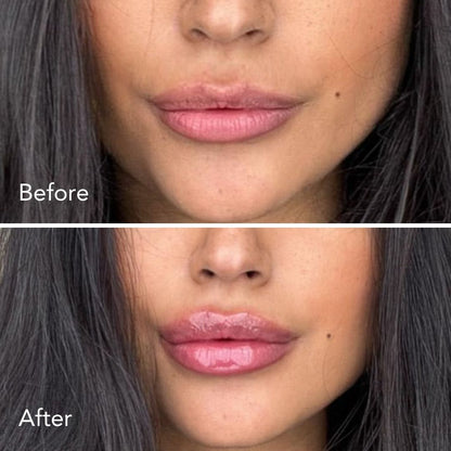 LushLine™ Lip Plumper